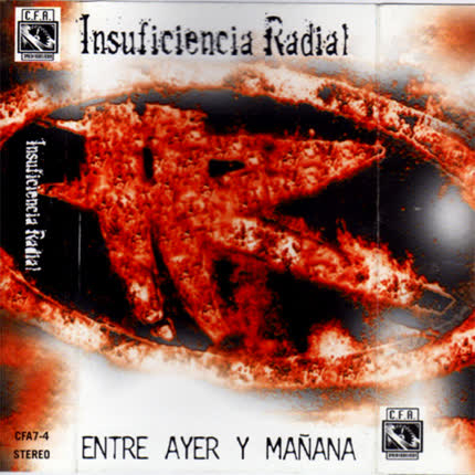 Carátula INSUFICIENCIA RADIAL - Entre ayer y mañana