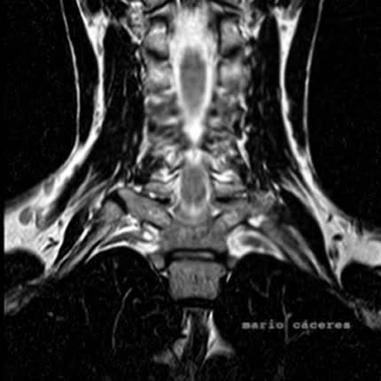 Carátula MARIO CACERES - Mario Cáceres